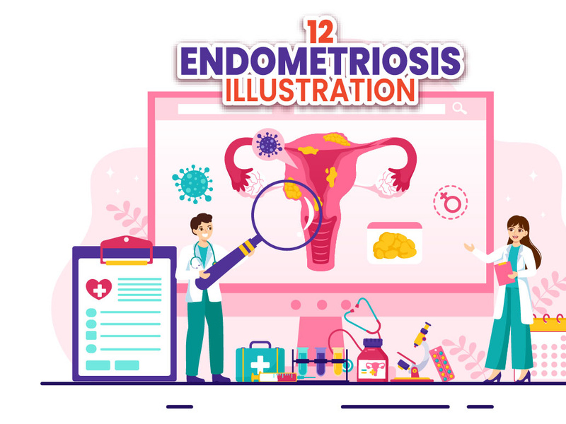 12 Endometriosis Illustration by denayuneep ~ EpicPxls